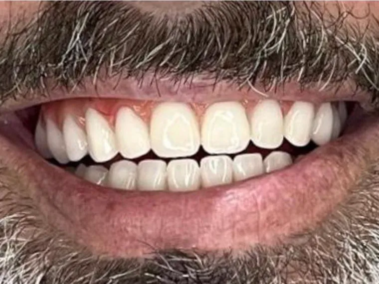 Sorriso de paciente após tratamento na clínica.