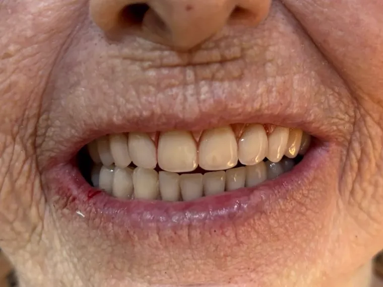 Sorriso de paciente após tratamento na clínica.