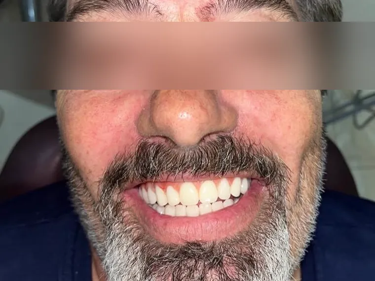 Sorriso de paciente, identidade preservada.