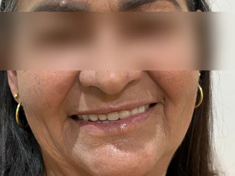Sorriso de paciente, identidade preservada.